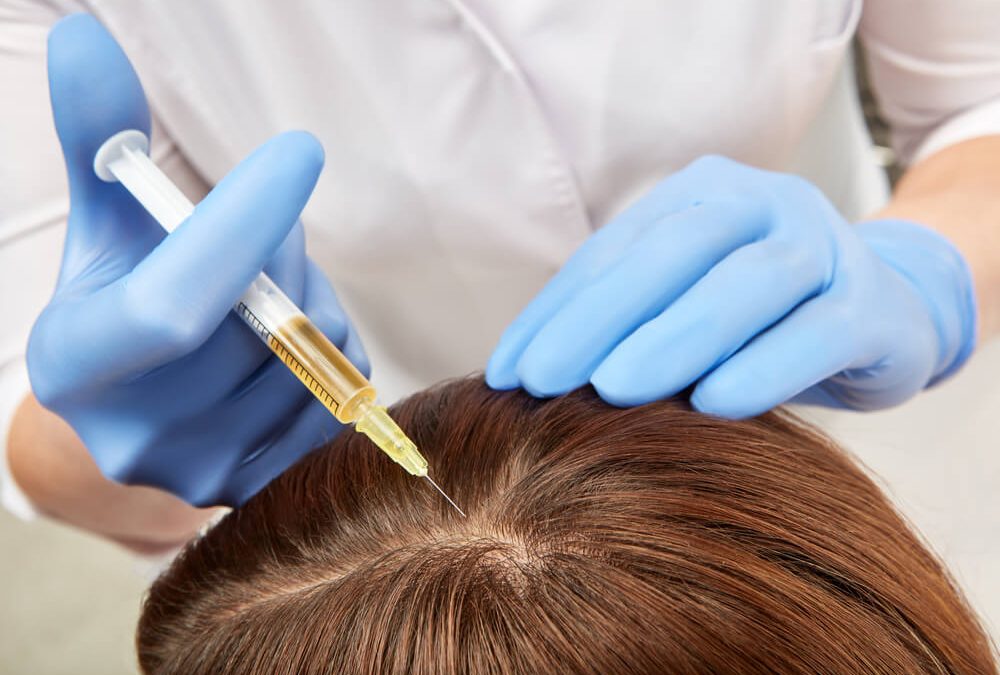 Unveiling The Potential Of PRP Therapy In Bass Hill: Leveraging Platelets For Skin And Hair Health